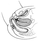 descente-organe-6